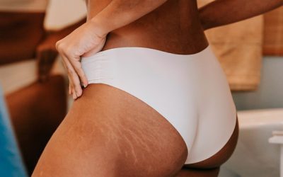 ¿Retención de líquidos?